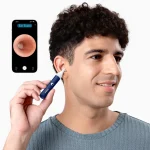 گوش پاک کن هوشمند شیائومی مدل Bebird I35R(اصل) - Image 2