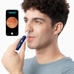گوش پاک کن هوشمند شیائومی مدل Bebird I35R(اصل) - Image 3